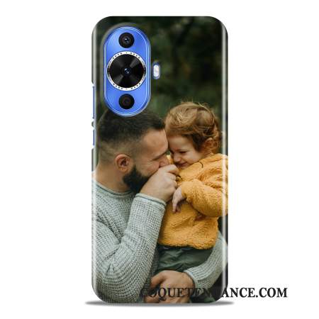 Coque personnalisée Huawei Nova 12S